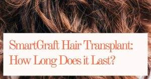 SmartGraft Hair Transplant