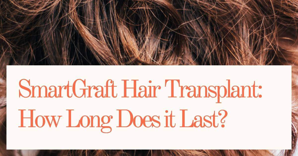 What is SmartGraft Hair Transplant and How Long Does it Last?
