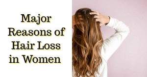 Reasons of Hair Loss in Women