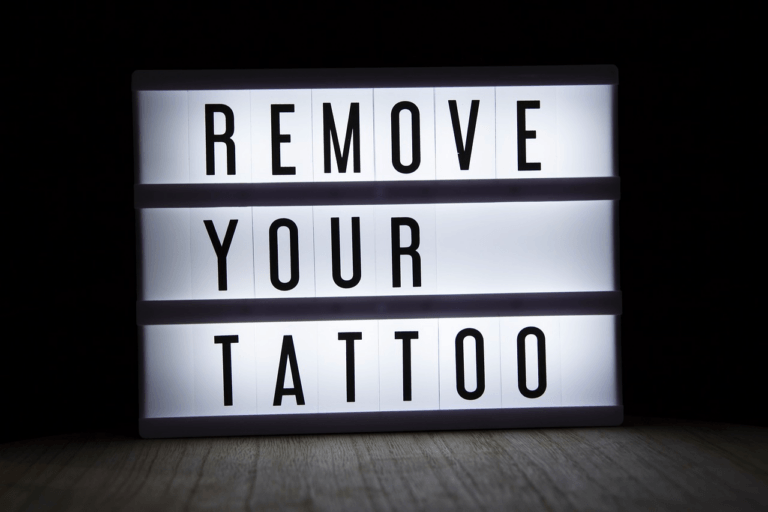 Exploring 10 Best Tattoo Removal Methods and Their Effectiveness